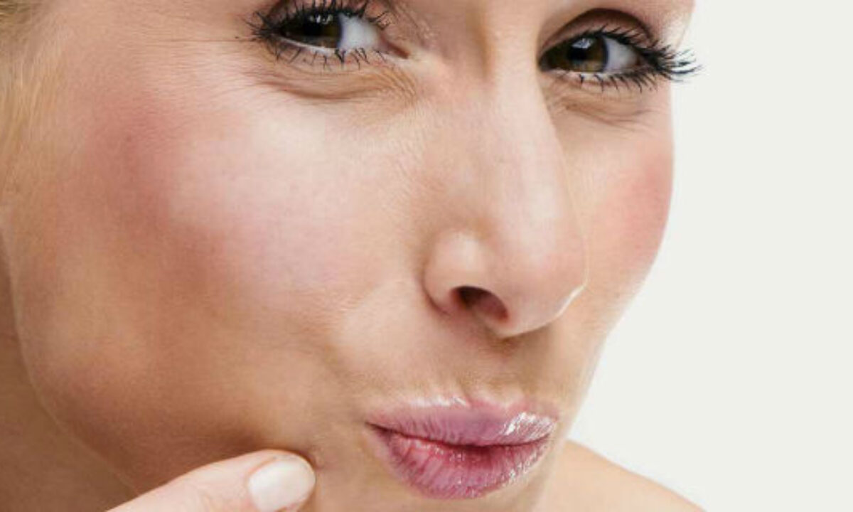 Brufoli sul mento: per nulla dolorosi, assolutamente antiestetici