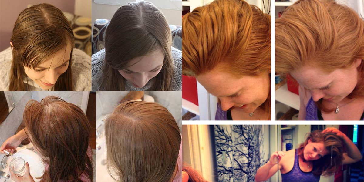 2 Blogger Non Lavano I Capelli Per 20 Giorni Ecco Cosa E Successo