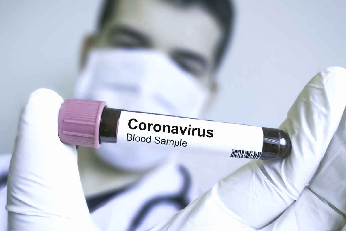 CoronaVirus