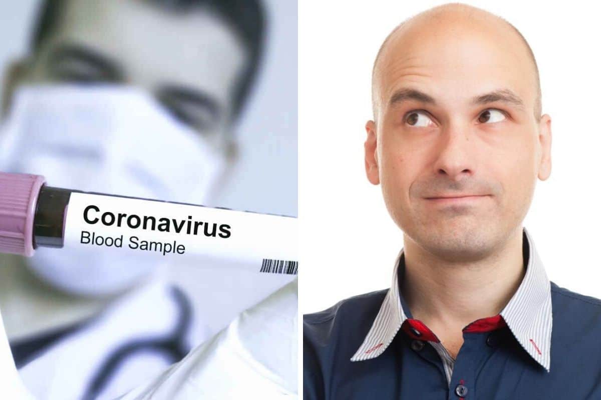 coronavirus-calvizie