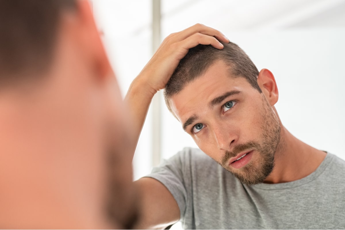 li Uomo Ecco I Migliori Quando Si Iniziano A Perdere I Capelli Capellistyle