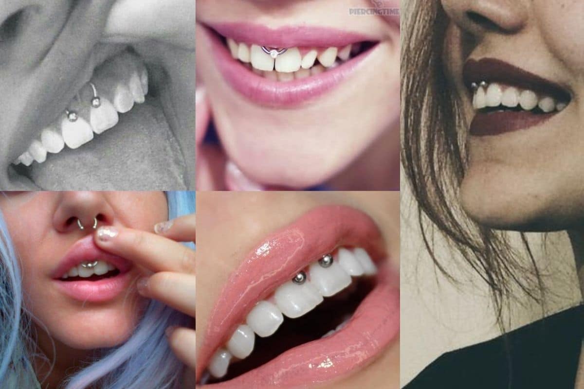 smile piercing