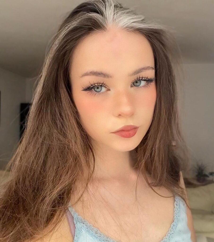 Nadine Breaty la ragazza con i capelli bianchi che sfida i bulli(08)