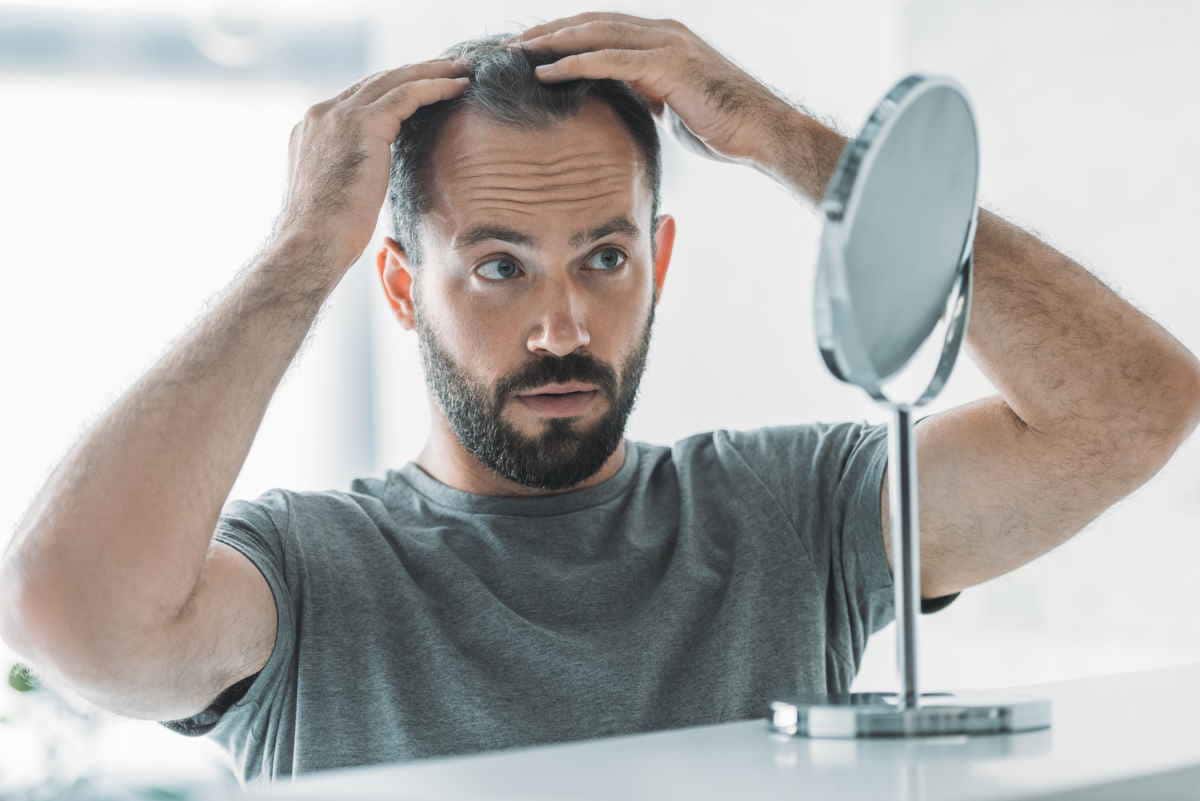 caduta capelli cibi