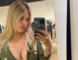 wanda nara no filtri cellulite acne look