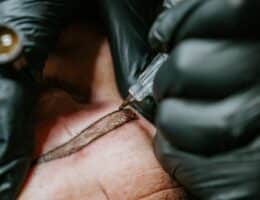 Trattamento di microblanding o tatuaggio