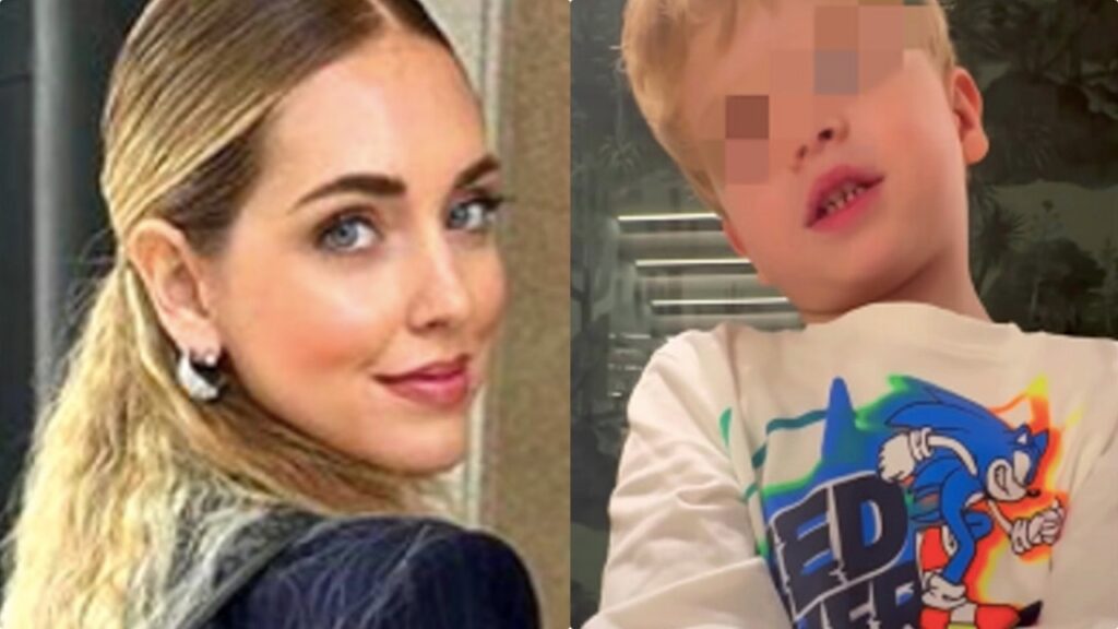 Leone cool come mamma Chiara Ferragni: la pettinatura con mollettine e fermaglietti