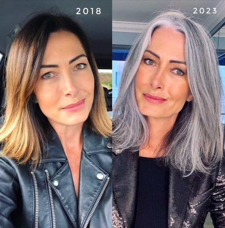 Capelli grigi: vitamine e integratori che prevengono l'ingrigimento precoce