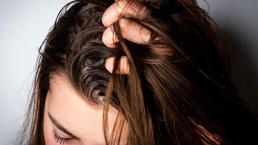 Quali sono le cause dei capelli grassi?
