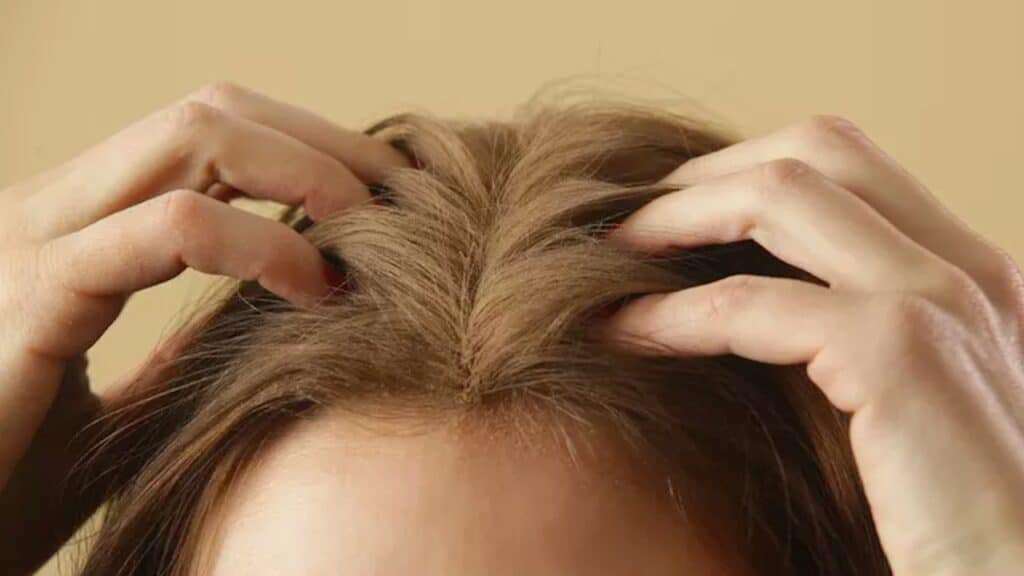 Va bene usare il bicarbonato di sodio sui capelli? Cosa ne pensano gli esperti