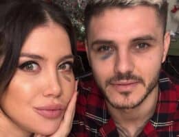 wanda-nara-occhio-nero