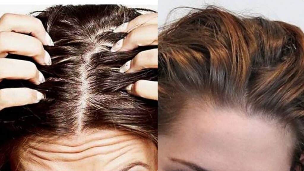 Capelli che si sporcano subito: si può rimediare nel giro di una settimana (spendendo 10 euro)