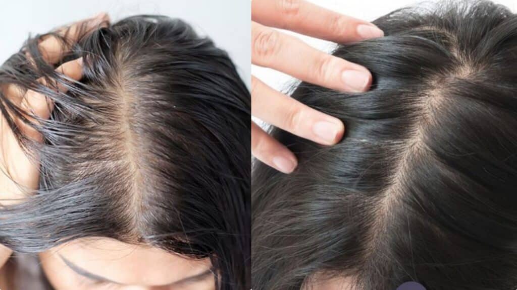 6 consigli per non perdere i capelli