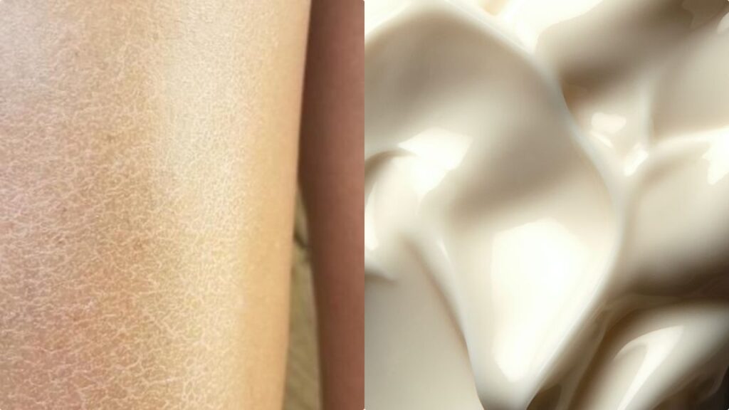 Pelle viso e corpo secchissima come fare: i migliori prodotti ultra nutrienti