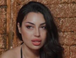 jenny-temptation-island-filler-labbra-motivo