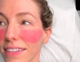 blush-tatuaggio-come-si-realizza-prezzo