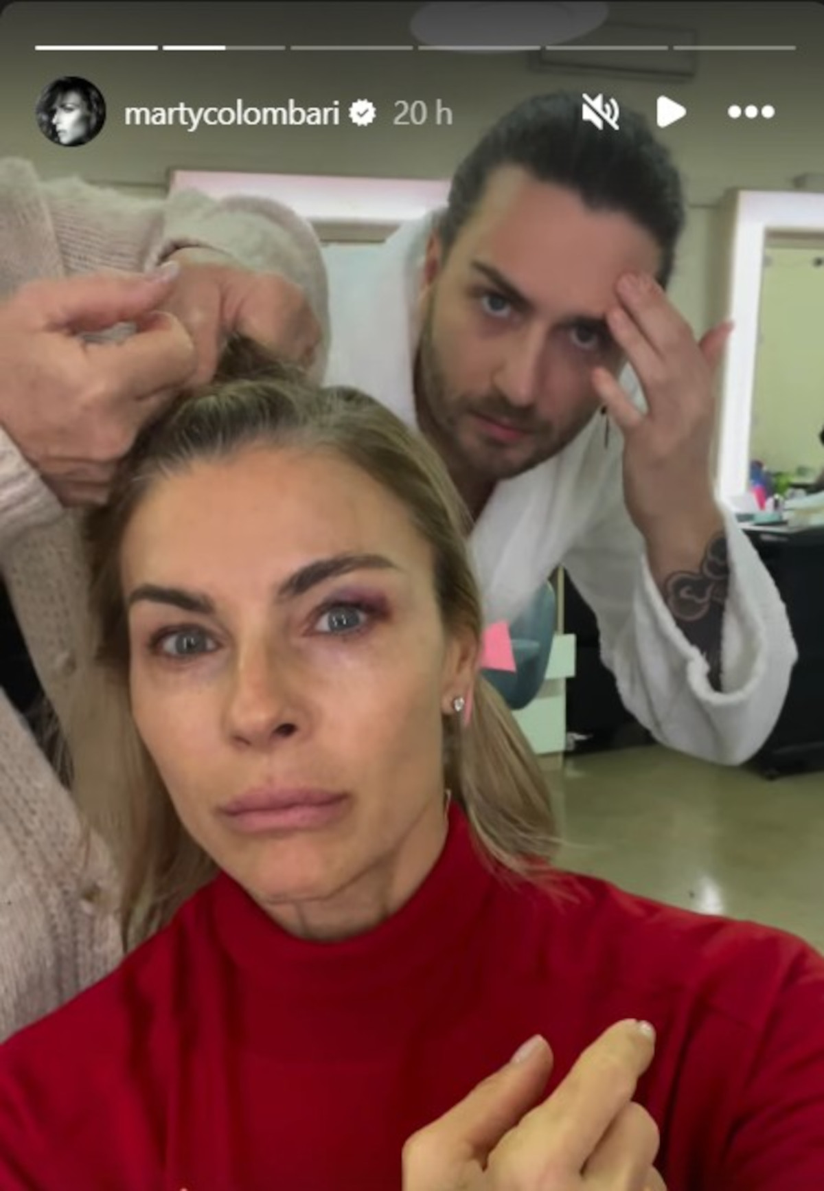 martina-colombari-occhio-nero